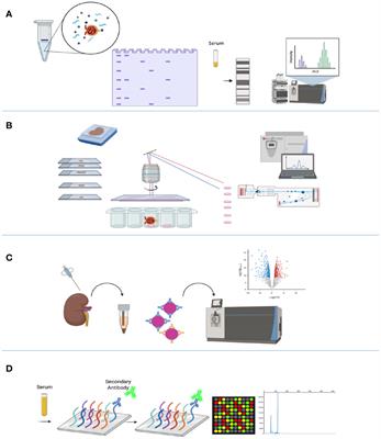 How Times Have Changed! A Cornucopia of Antigens for Membranous Nephropathy